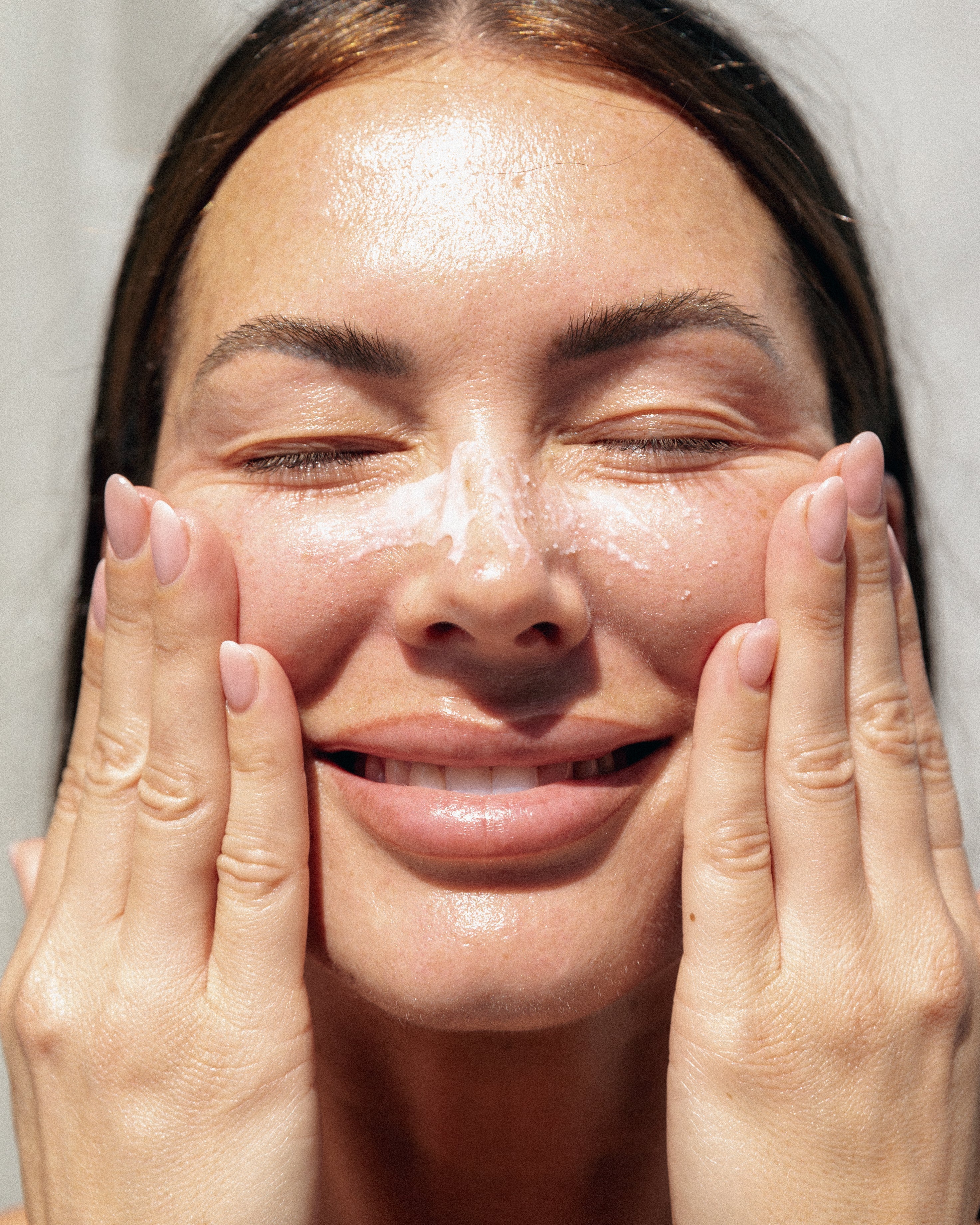 Rosacea