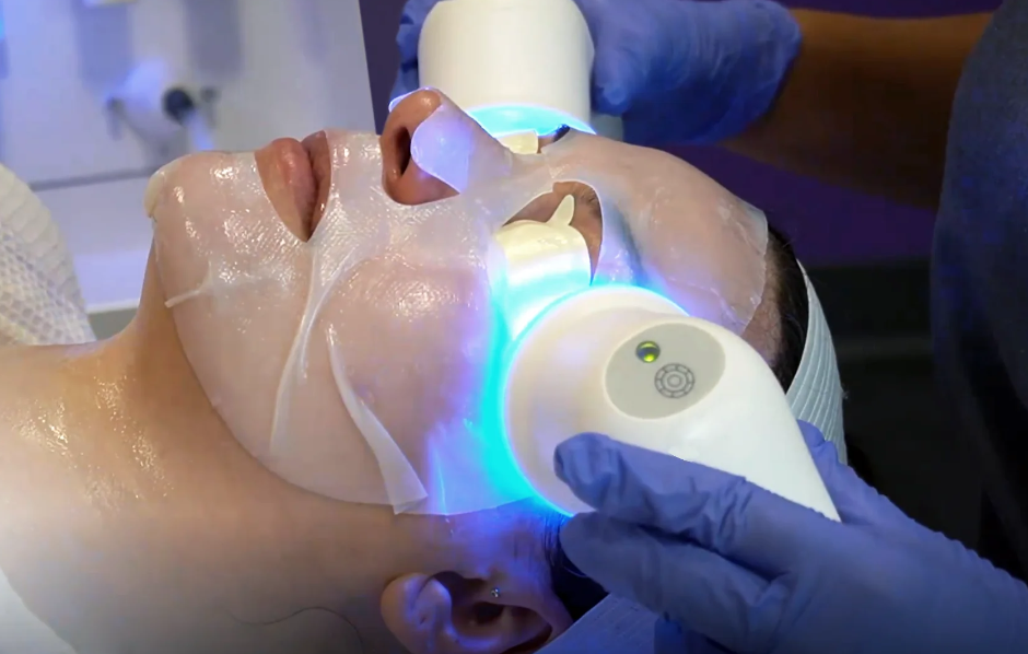 Glace_Treatment.png